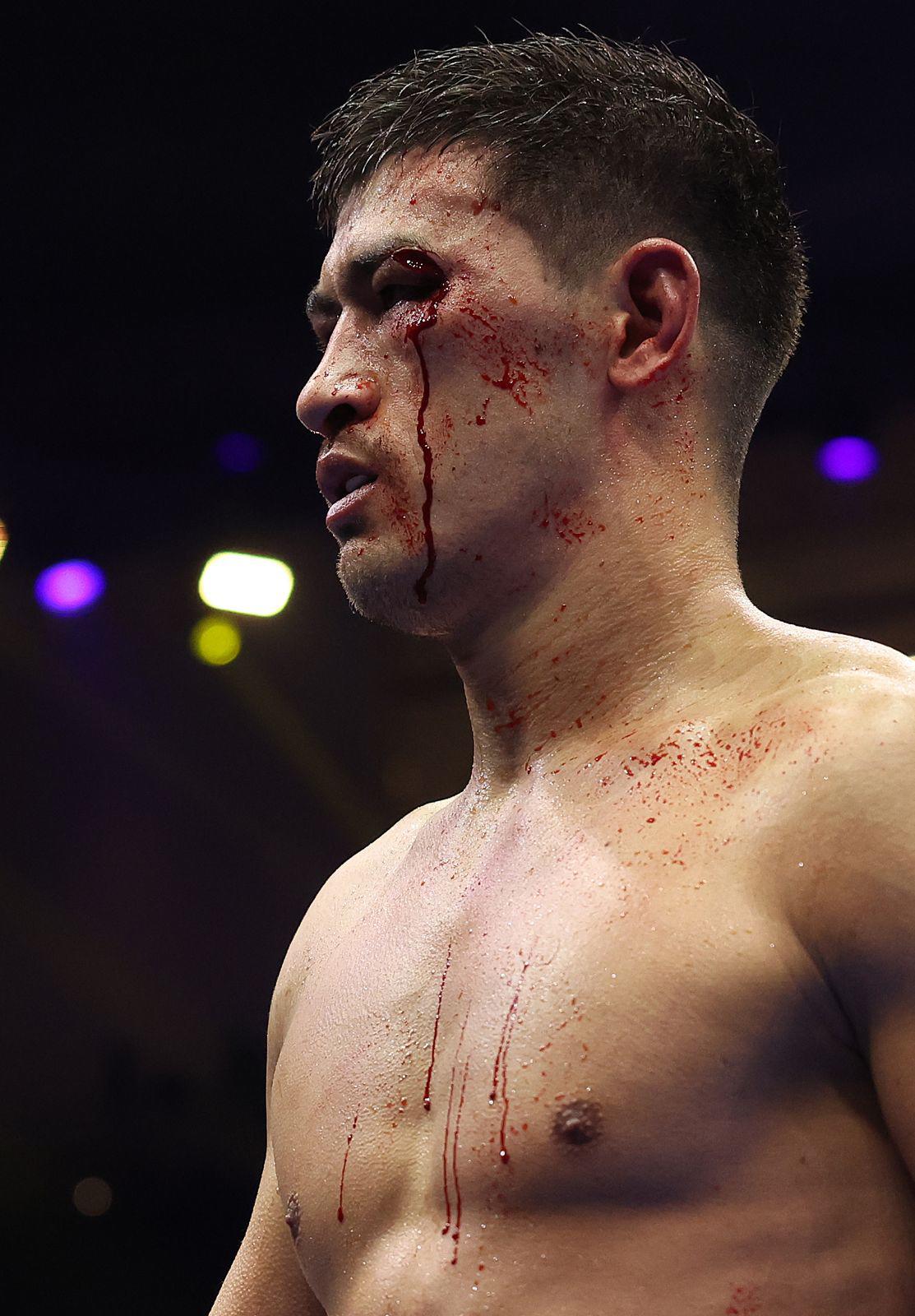 $!Bivol considera ascender a peso Crucero tras convertirse en campeón indiscutido de peso Semipesado