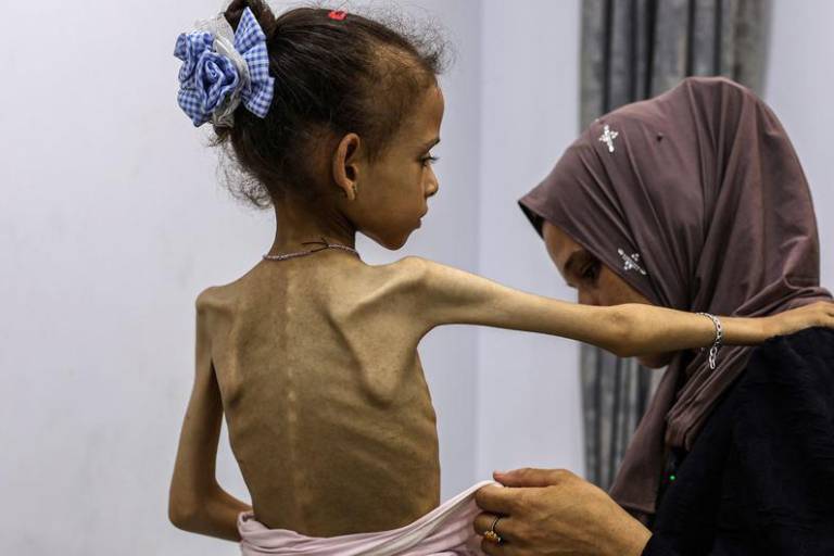 Cada vez hay más indicios de hambruna e inanición generalizada en Gaza