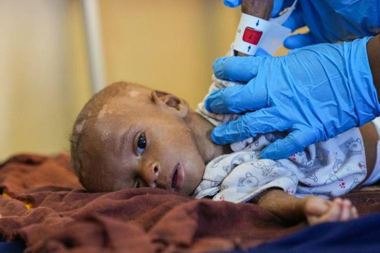 Cuerno de África: La OMS solicita fondos para evitar muertes por hambre y enfermedades