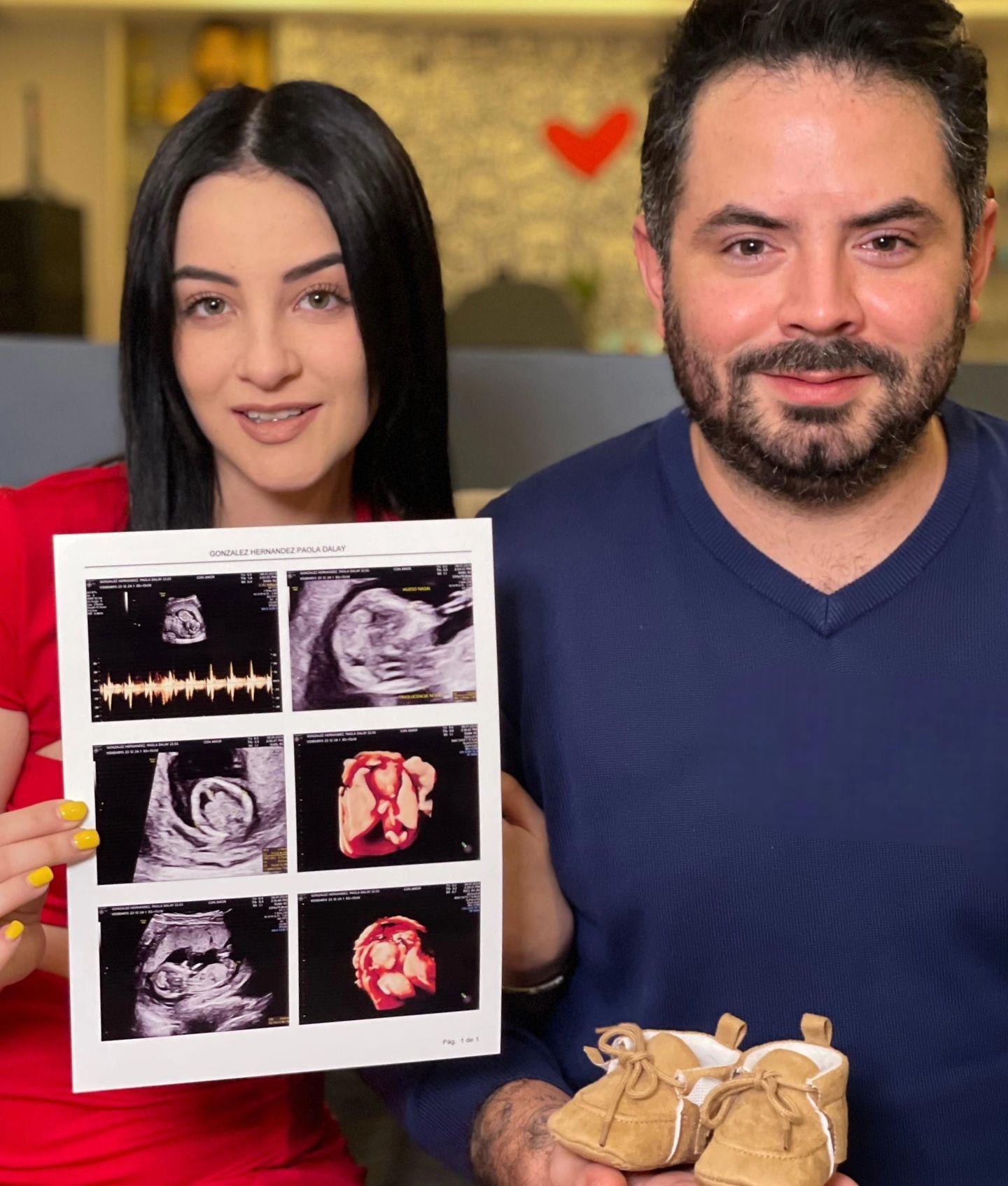 $!Revela José Eduardo Derbez el nombre de su bebé