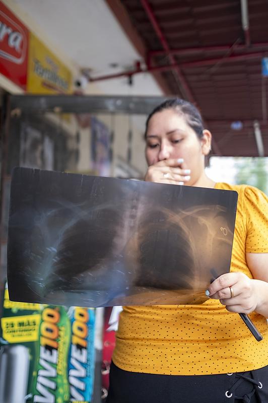 $!Elena Marisol Izaguirre muestra una radiografía de sus pulmones; se pregunta si la contaminación explica en parte sus problemas respiratorios.
