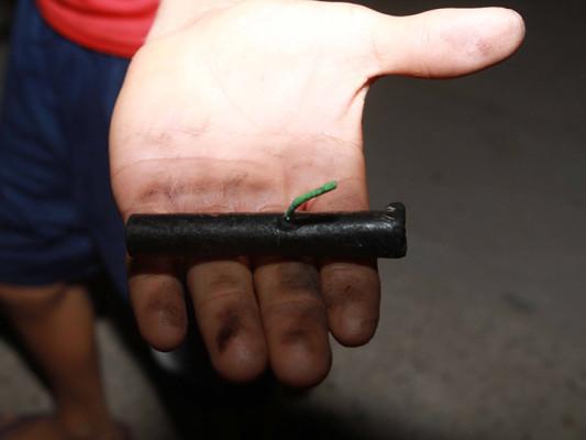 Menor de 10 años sufre quemaduras por pirotecnia en Los Mochis