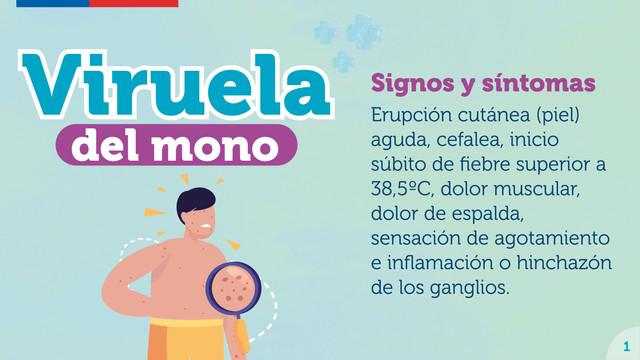 Viruela del mono.
