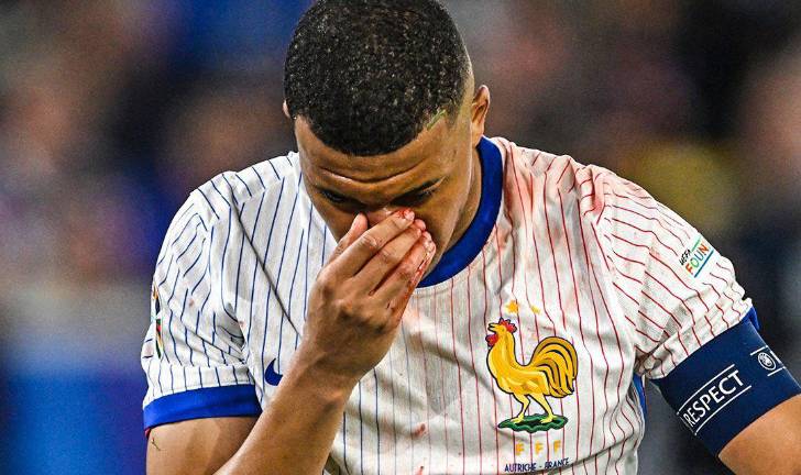 Kylian Mbappé sale con la nariz ensangrentada.