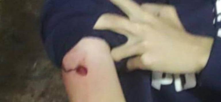 La víctima, un joven que viajaba en el camión, presentó una herida en el brazo.
