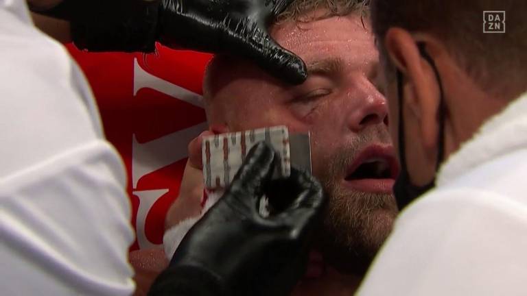 Billy Joe Saunders la pasa muy mal tras la derrota ante Saúl “Canelo” Álvarez.
