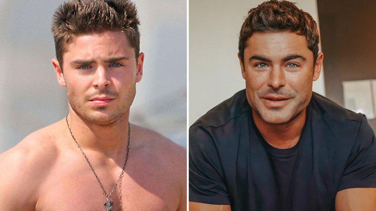 Sorprende el “nuevo rostro” de Zac Efron