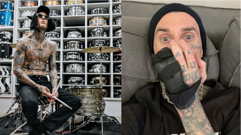 Travis Barker será sometido a operación en uno de sus dedos.
