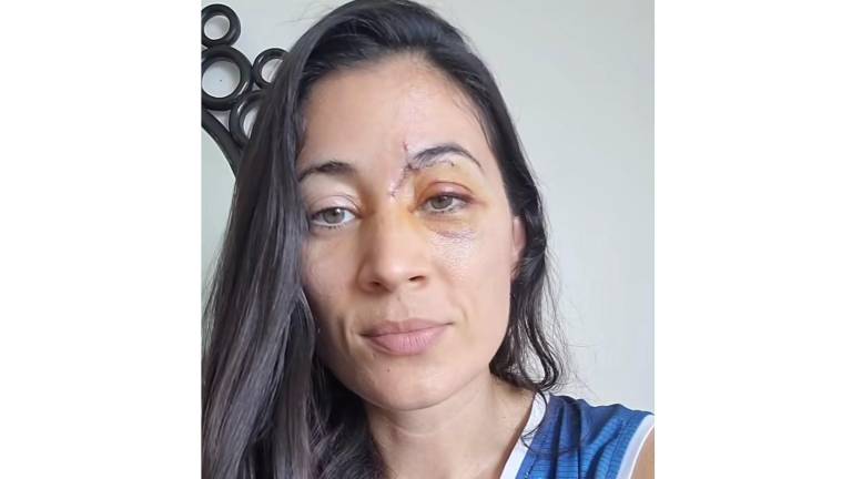 Shuyein Sáenz fue arrollada por una persona que manejaba un scooter por la zona de la ciclovía en el malecón.