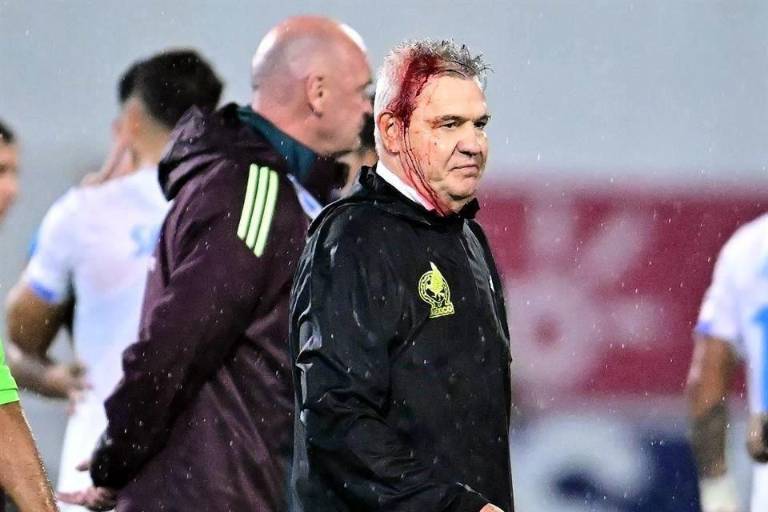 Javier Aguirre sufrió un fuerte corte en la cabeza producto del impacto de un proyectil