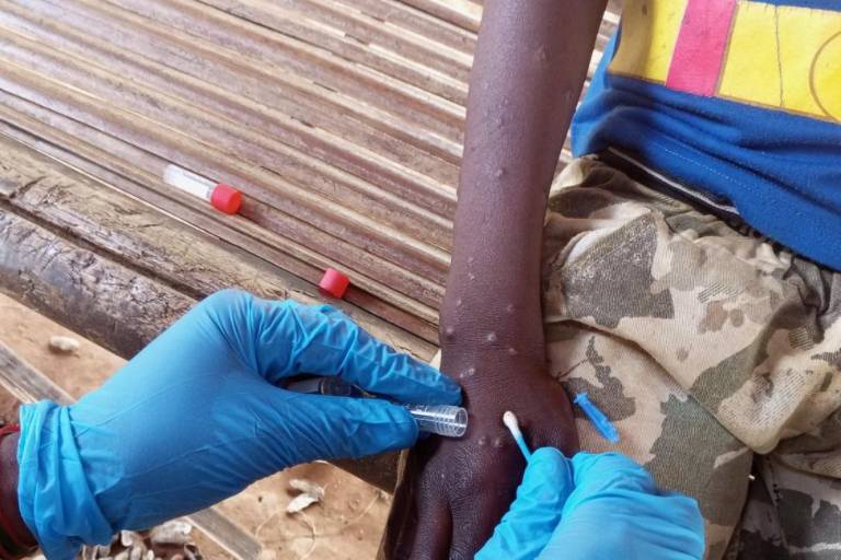 Organización Internacional para las Migraciones solicita fondos para responder al aumento de casos de mpox