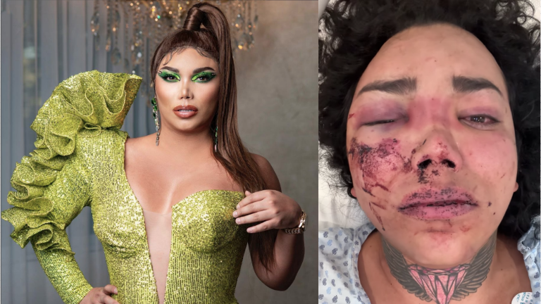 Paola Suárez fue golpeada por su pareja.