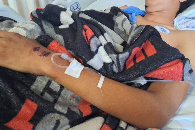 Pide abuela de Caleb Antonio apoyo para tratamiento del joven tras sufrir descarga eléctrica
