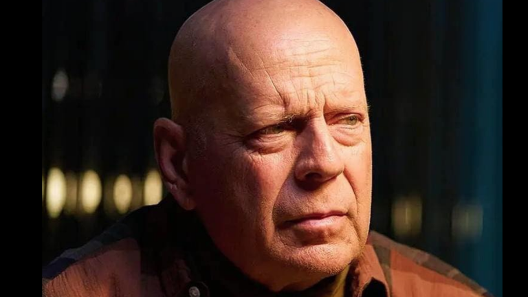 El actor fue diagnosticado con la condición Afasia.