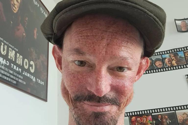 Muere Darren Kent, actor de ‘Game of Thrones’, a los 36 años