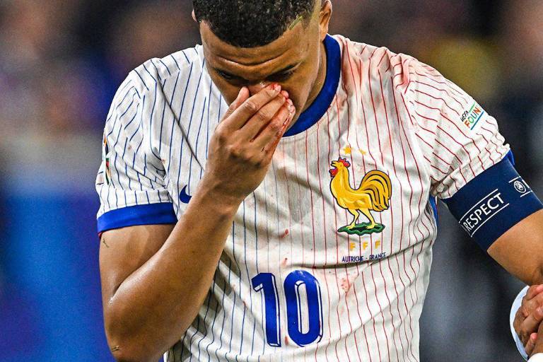 Confirman fractura de nariz de Kylian Mbappé tras el Austria versus Francia en la Euro 2024