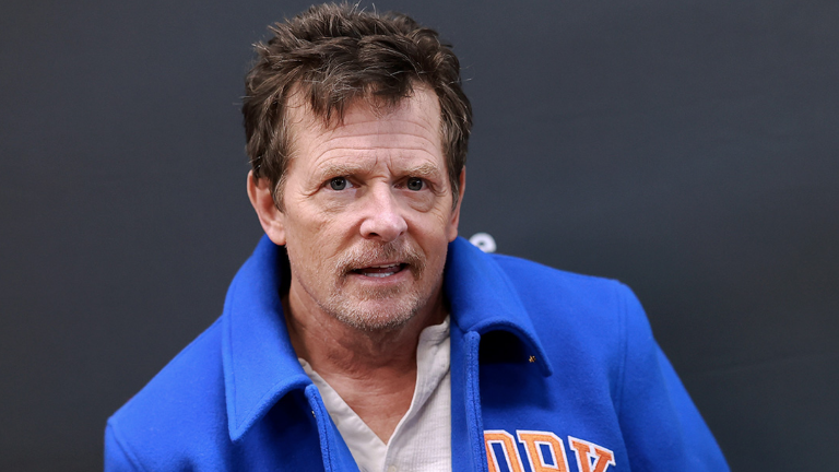 Michael J. Fox causa preocupación a sus fans por su estado de salud.