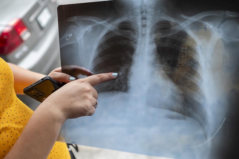 $!Elena Marisol Izaguirre muestra una radiografía de sus pulmones; se pregunta si la contaminación explica en parte sus problemas respiratorios.