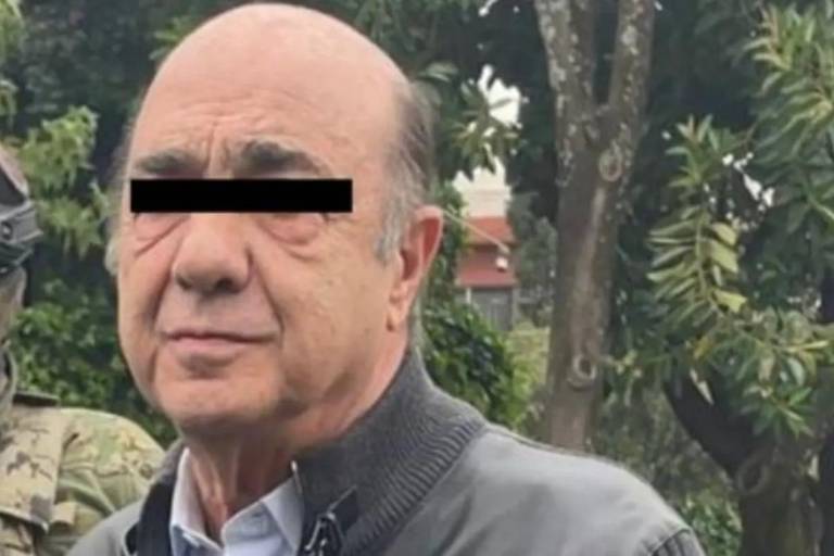 Murillo Karam se encuentra en terapia intensiva por una carótida obstruida