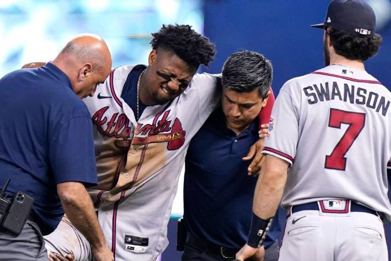 Ronald Acuña fuera todo el año; Manny Machado va al All-Star
