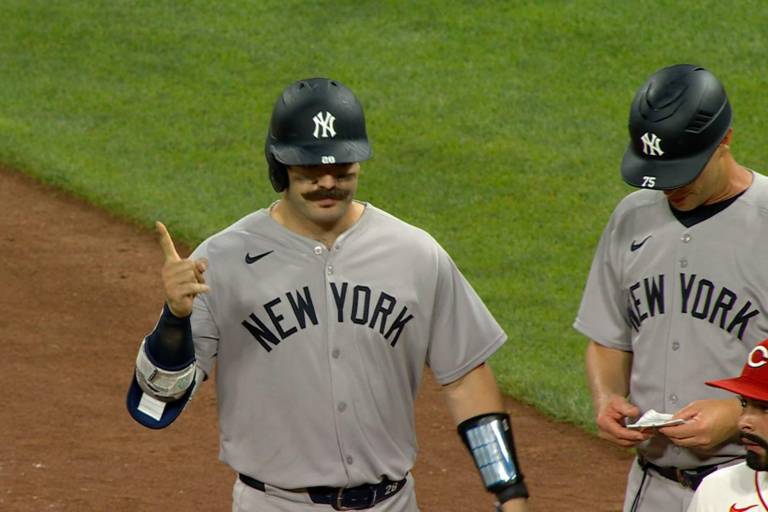Yanquis agrega dos peloteros a la lista de lesionados