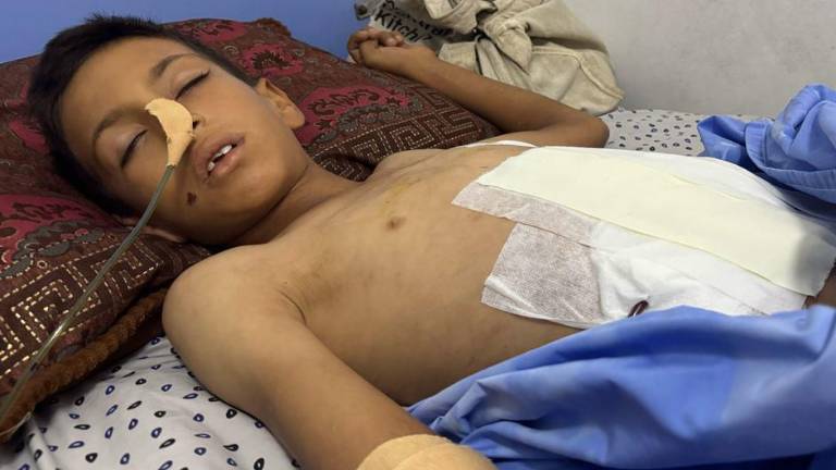 Un niño herido recibe tratamiento en el hospital Al Helou en la ciudad de Gaza.