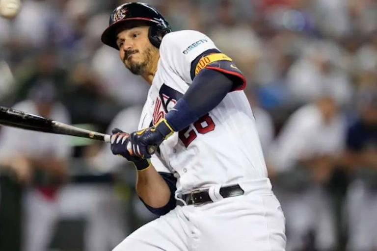 Nolan Arenado deja juego por bolazo en una mano; no hay fractura